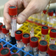 Samples being prepared for a blood test.